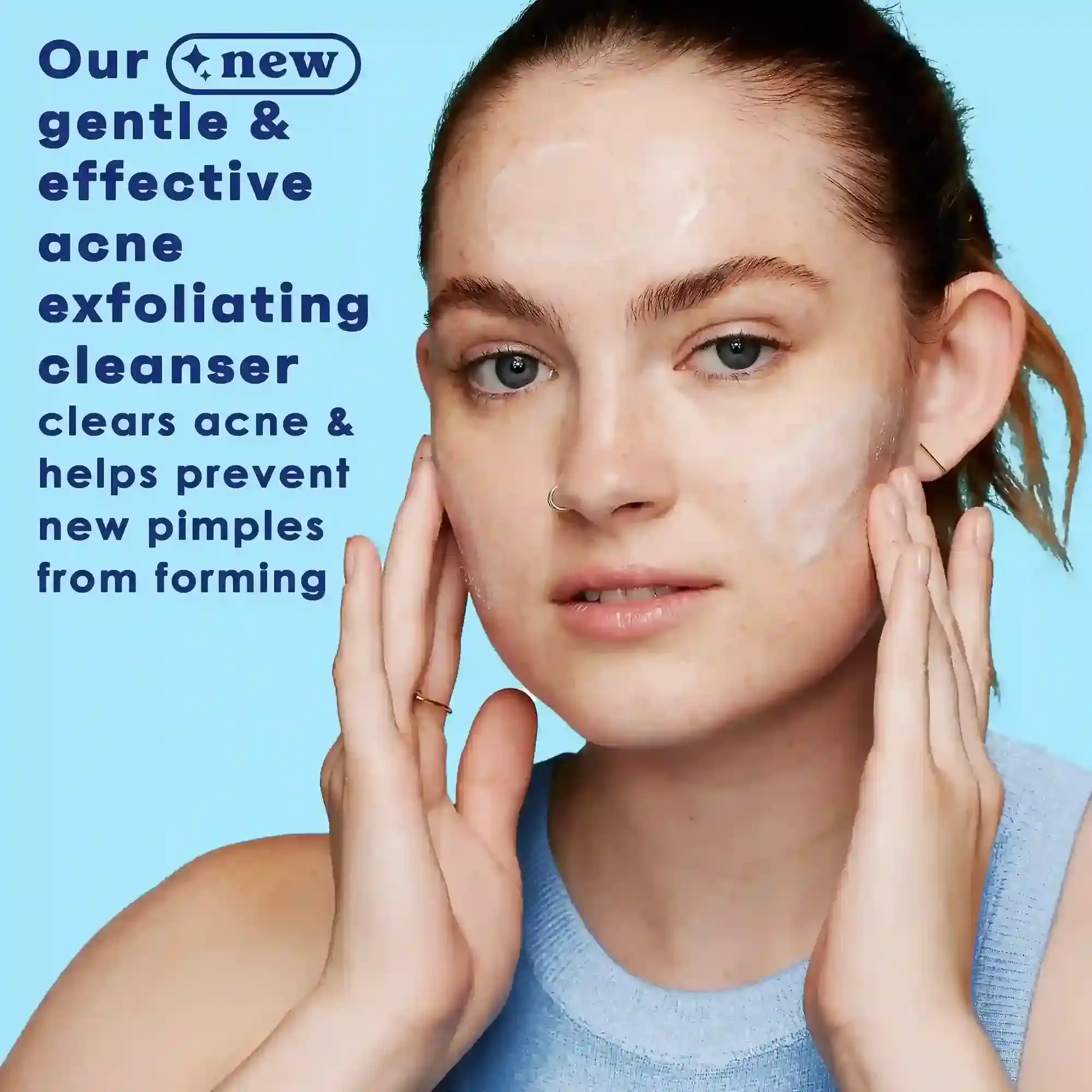 A person gently applies cleanser to the face, promoting skincare. Text reads: "Our new gentle & effective acne exfoliating cleanser clears acne & helps prevent new pimples from forming." Light blue background.