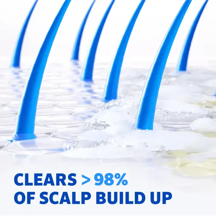 Men's ROGAINE® Pre-Growth 2-in-1 Shampoo showing 98% scalp build-up clearance Men's ROGAINE® Pre-Growth 2-in-1 Shampoo showing 98% scalp build-up clearance