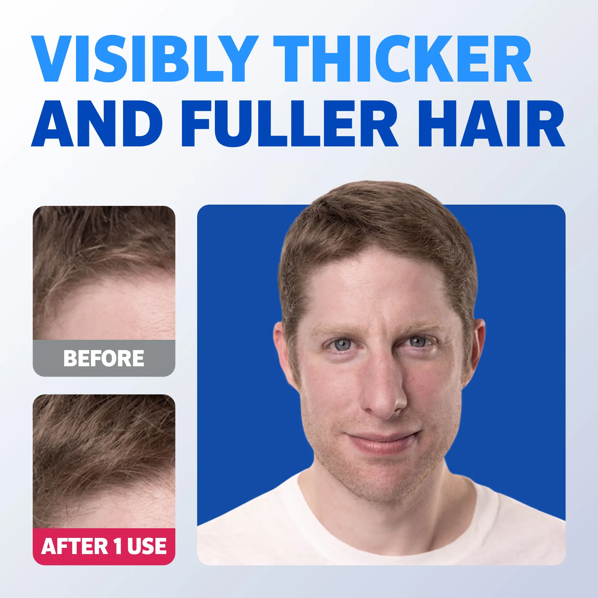 A before and after picture of a man with light brown hair showing visibly thicker and fuller hair. A before and after picture of a man with light brown hair showing visibly thicker and fuller hair.