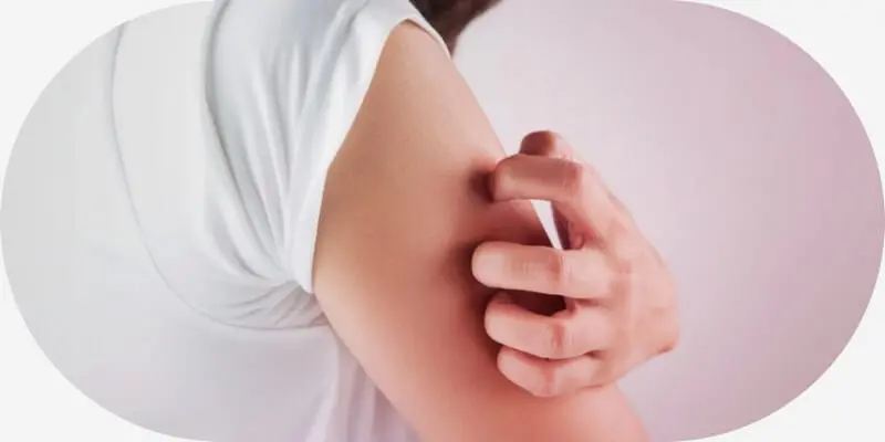 A person with itchy skin
