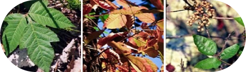 Poison Ivy, Oak, and Sumac Rashes: Symptoms and Treatments - Image 2 - Benadryl - en-US