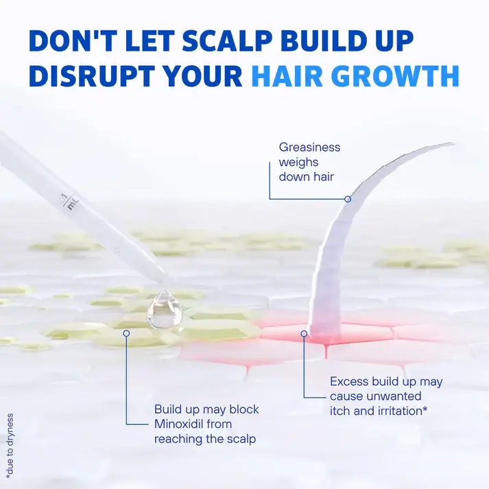 Men's Rogaine Pre-Growth Shampoo showing scalp health benefits Men's ROGAINE® Pre-Growth Shampoo showing scalp health benefits