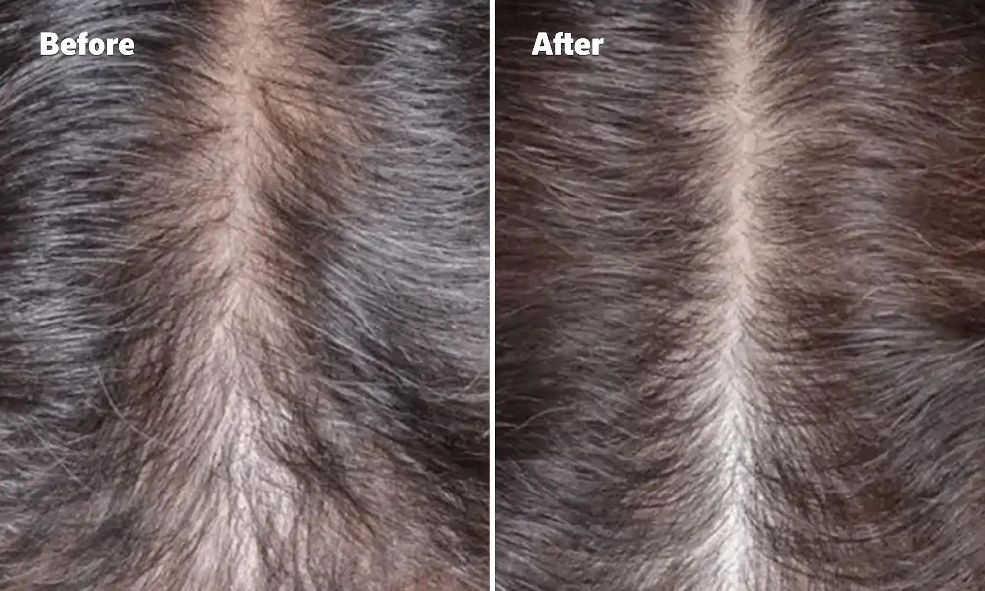  Before and After image, top of woman's scalp showing signs of hair regrowth.