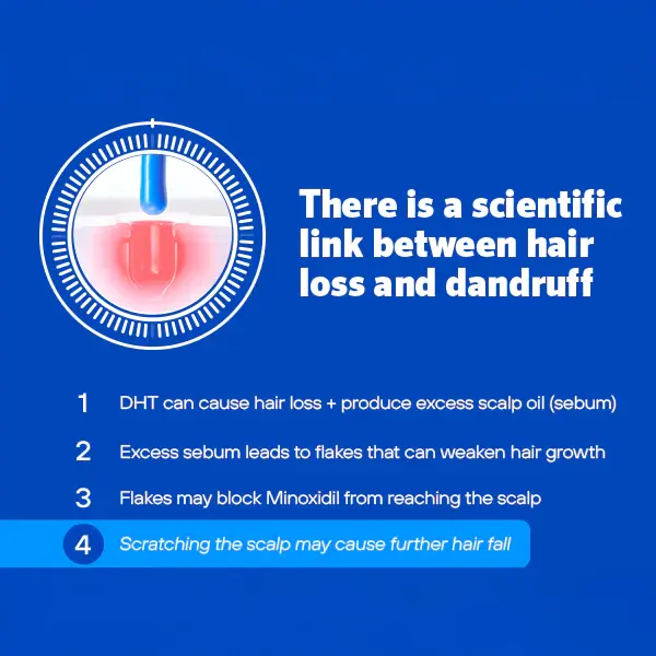 ROGAINE® 2% Salicylic Acid Anti-Dandruff Shampoo explaining the hair loss link ROGAINE® 2% Salicylic Acid Anti-Dandruff Shampoo explaining the hair loss link