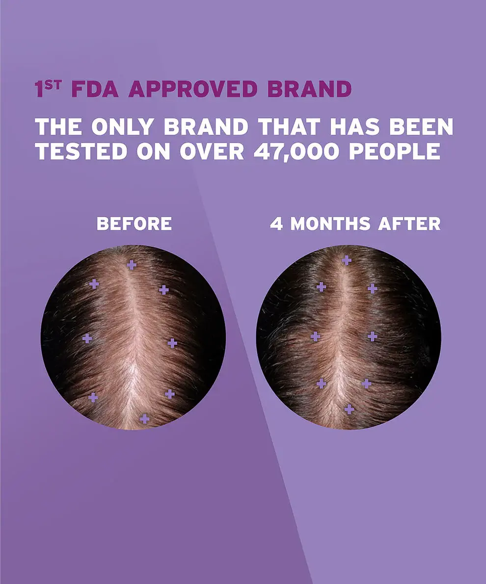 A before and after picture of a woman with dark brown hair showing hair regrowth.