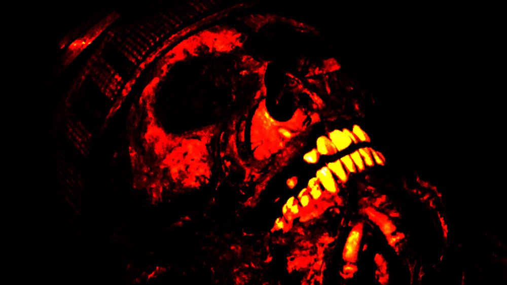 Bô-lê-rô Takeover | Miseria Humana