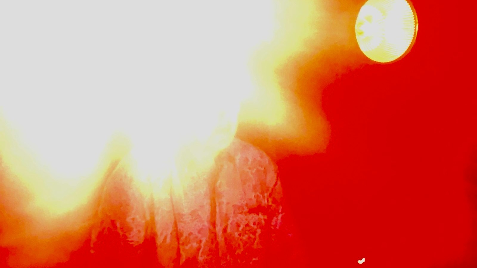 The Little Finger Show | Nick Höppner