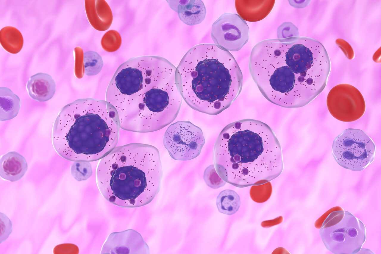 Ciltacabtagene Autoleucel (Carvykti) Improves Quality of Life in ...