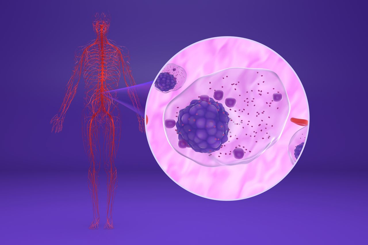Talquetamab-Containing Regimens Significantly Improve PFS in Relapsed/Refractory Myeloma