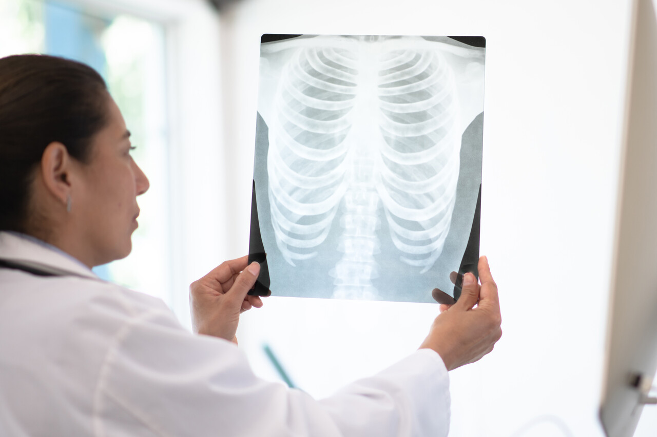 Novel ADC Improves Survival in Pretreated EGFR-Mutated NSCLC, Phase 3 Data Show