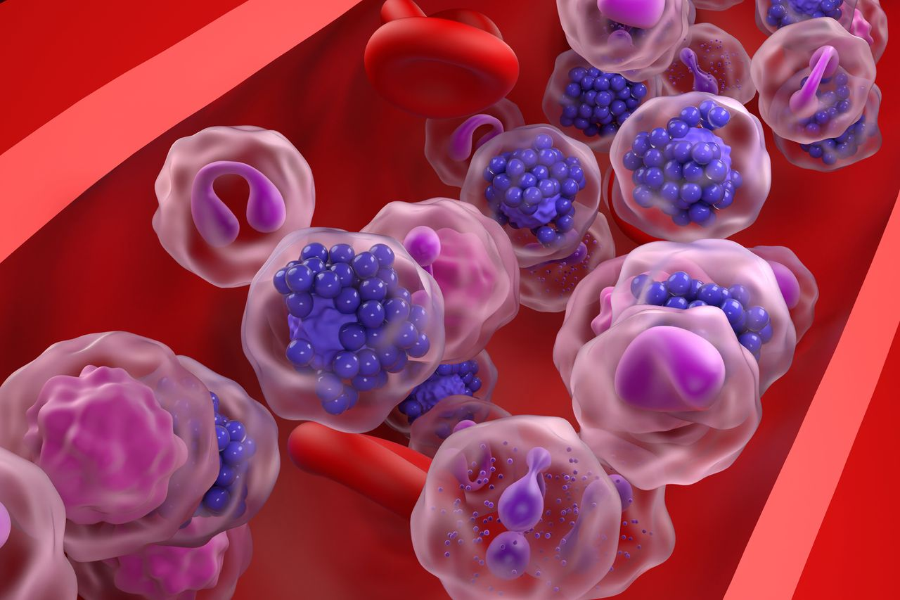 Key Highlights From ASCO 2026 in Diffuse Large B-Cell Lymphoma