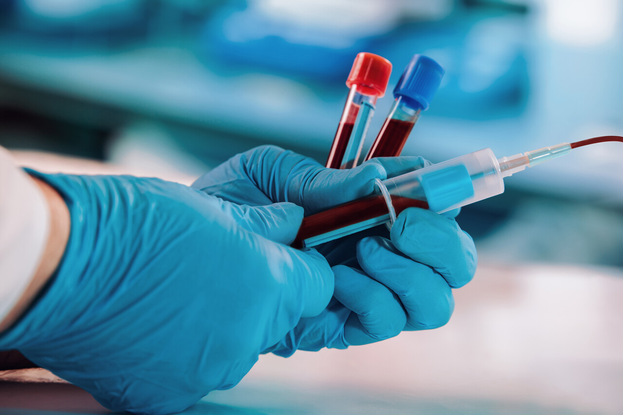 Screening Blood Test for 50 Cancers Shows Promise, But False-Positives High