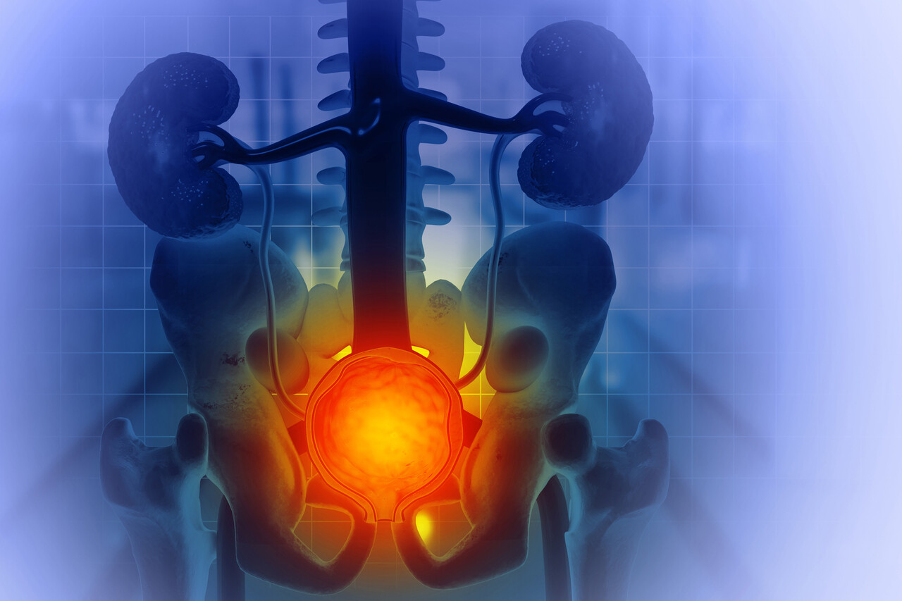 Bladder Cancer Care Enters New Era With Advanced Diagnosis and Treatments