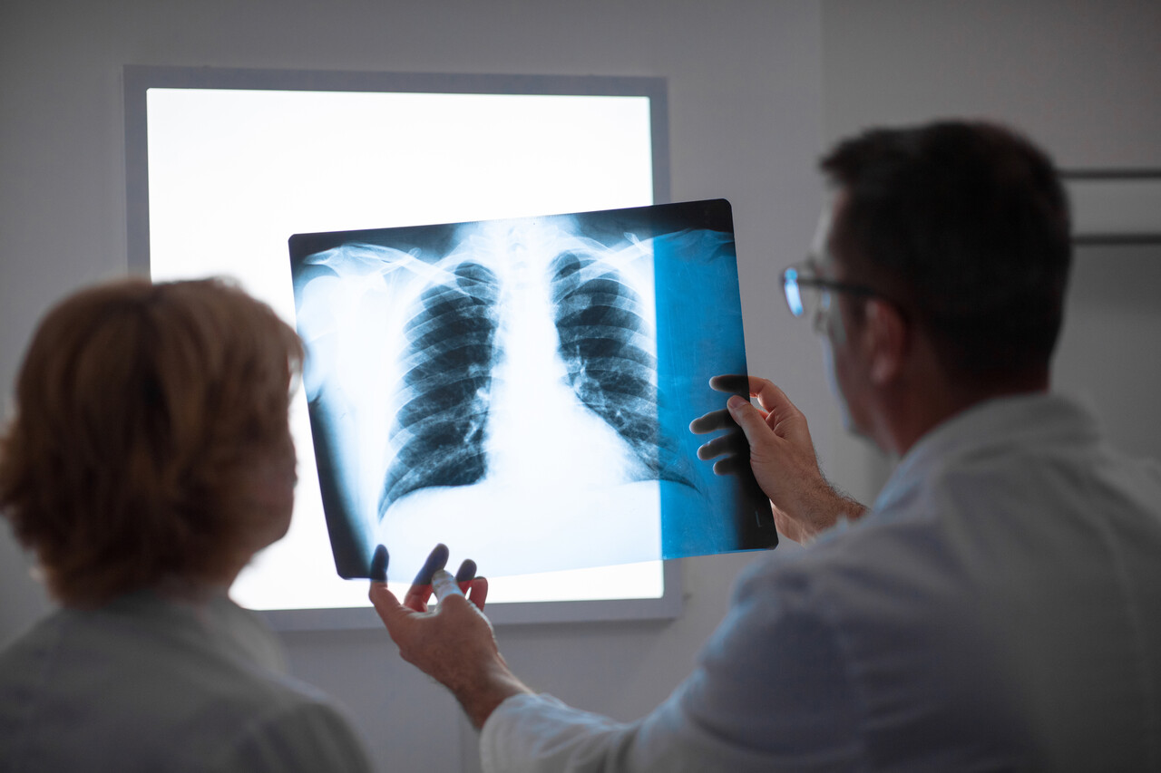 ROS1 vs ALK Positive NSCLC: Treatment Differences & Strategies