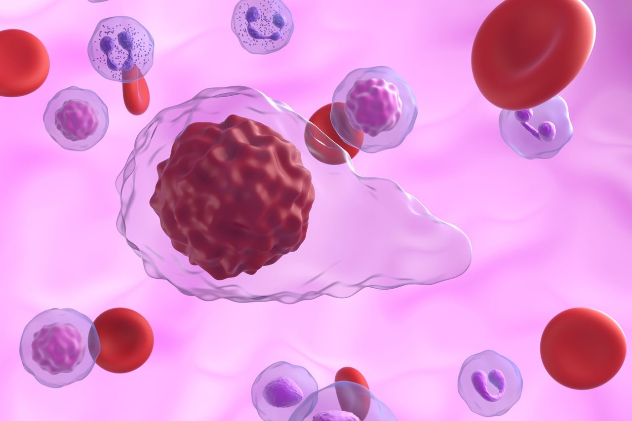 Combo Shows Benefit in Phase 3 Myelofibrosis Trial That Resurfaces Key Questions
