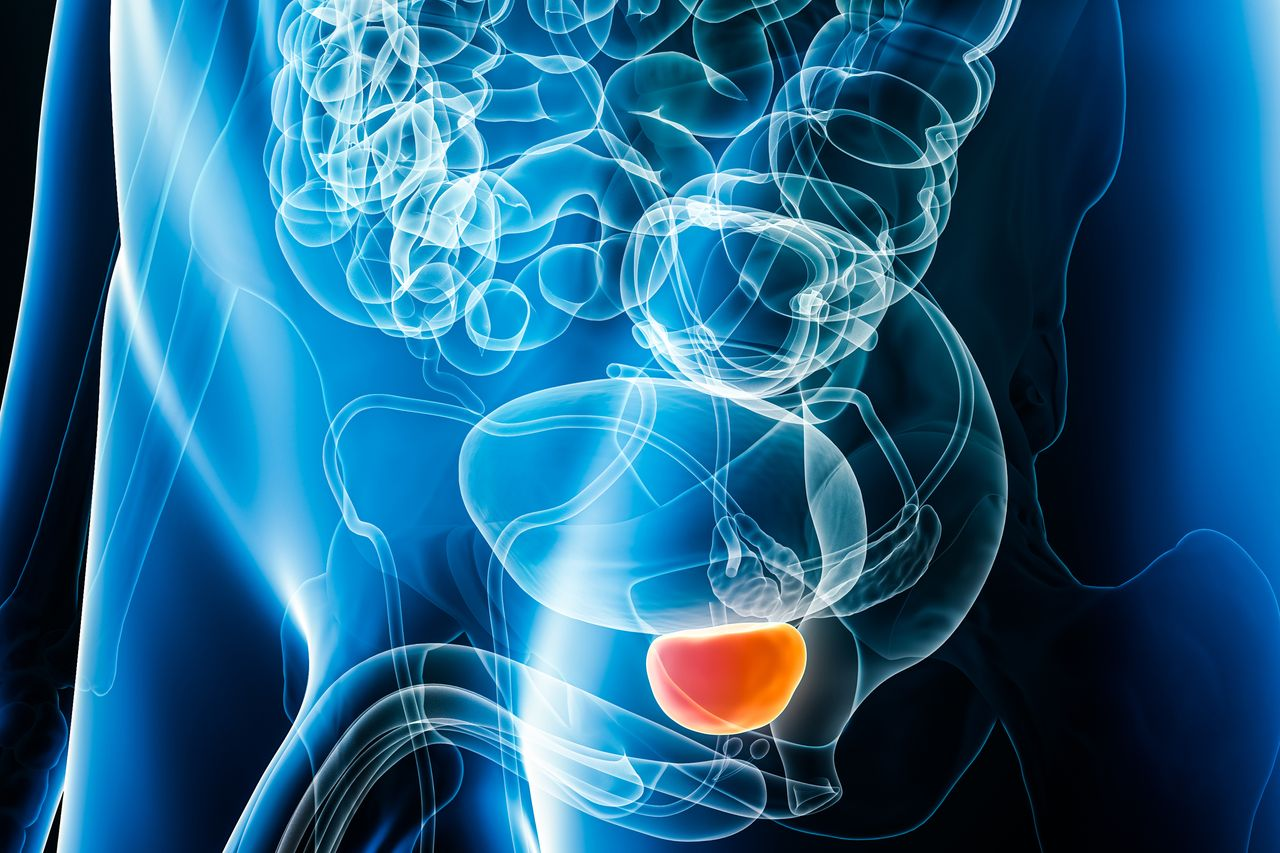 FDA Approves Lutetium Lu 177 Vipivotide Tetraxetan Plus ARPI for Prostate Cancer