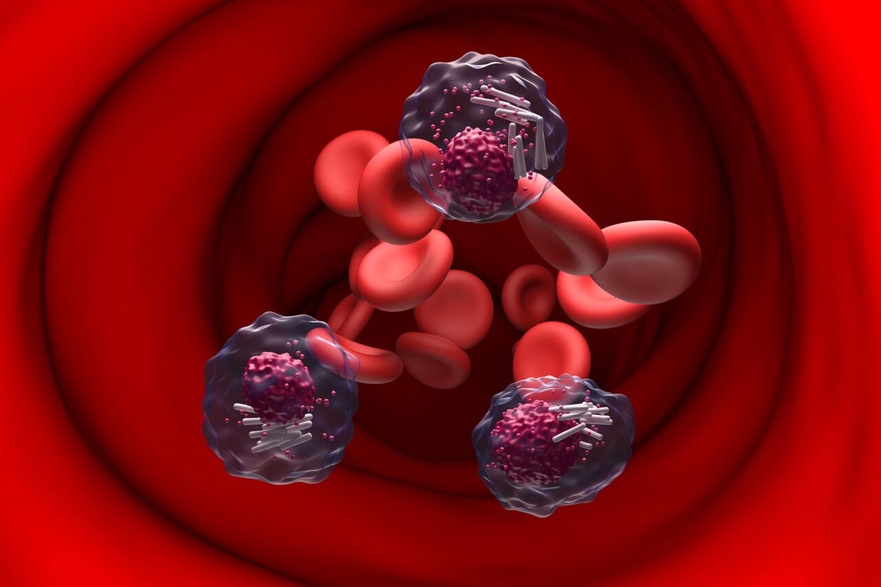 As Many as 40% of CLL Patients Don’t Need Specialized Follow-up, Data ...