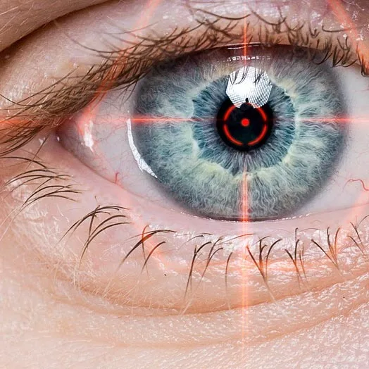 Cataract