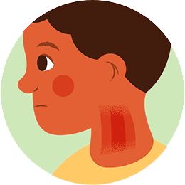 Itchy nose, mouth or throat