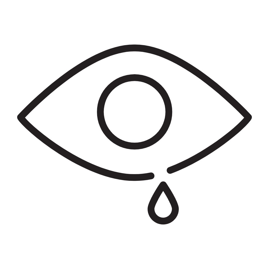 Watery eyes