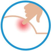 Diaper Rash Symptom: Sensitivity