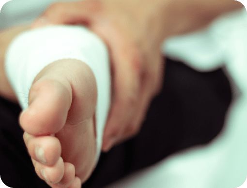 Close-up of a person's foot wrapped in gauze, ilustrating the comfort and security of HURT-FREE wraps.