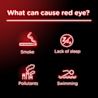 Red eye may be caused by smoke, lack of sleep, and swimming