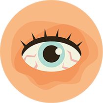 Swollen eye