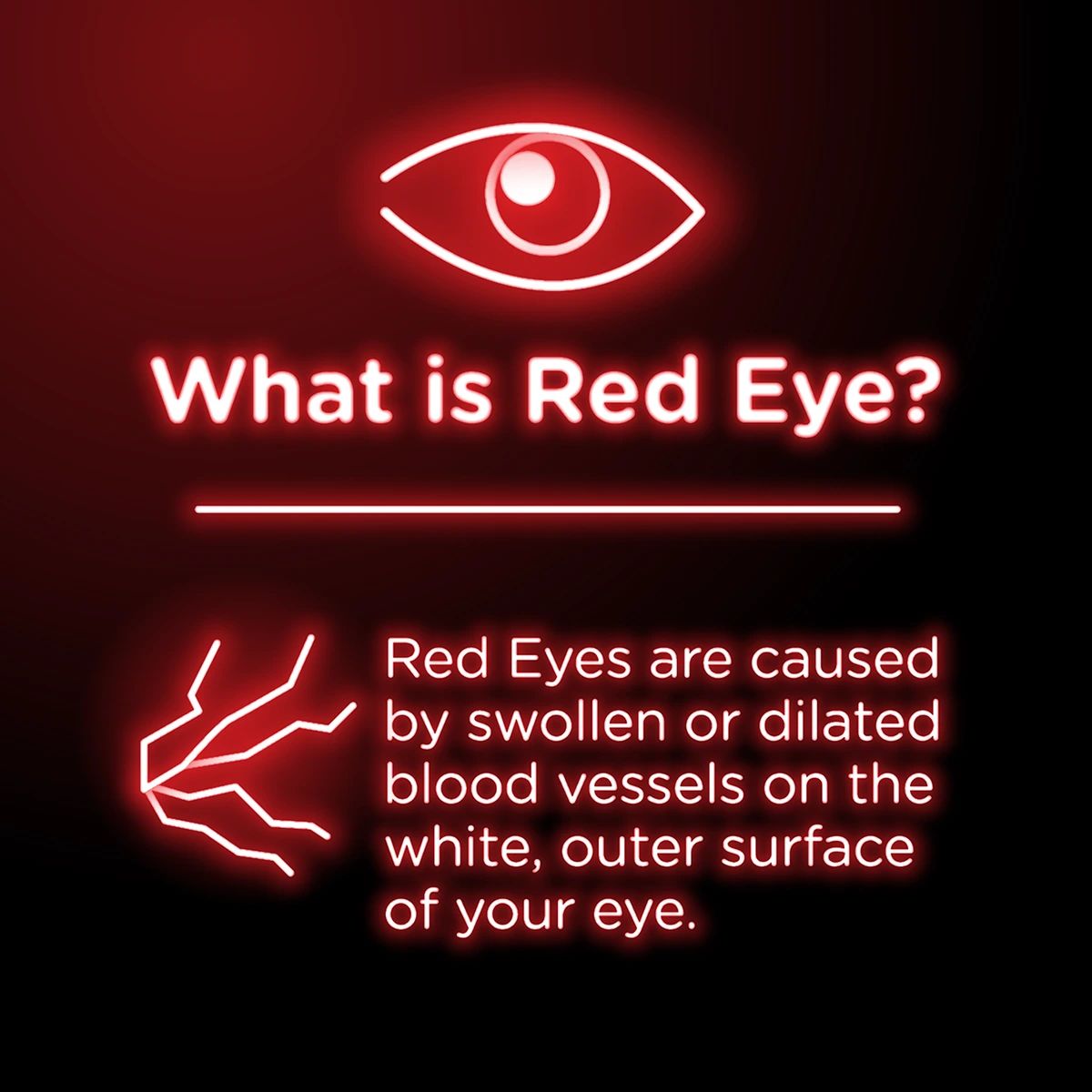 What is Red Eye? Red Eyes are caused by swollen or dilated blood vessels on the white, outer surface of your eye.