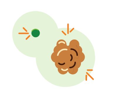 Sinus compared to the size of a pea