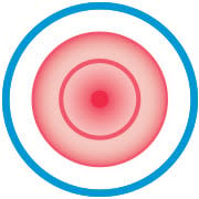 Diaper Rash Symptom: Pinkness or Redness