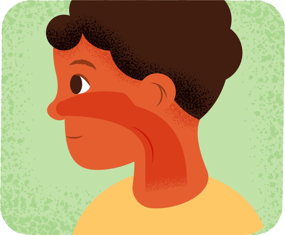 A child with post nasal drip from allergies