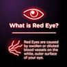 What is Red Eye? Red Eyes are caused by swollen or diluted blood vessels on the white, outer surface of your eye.