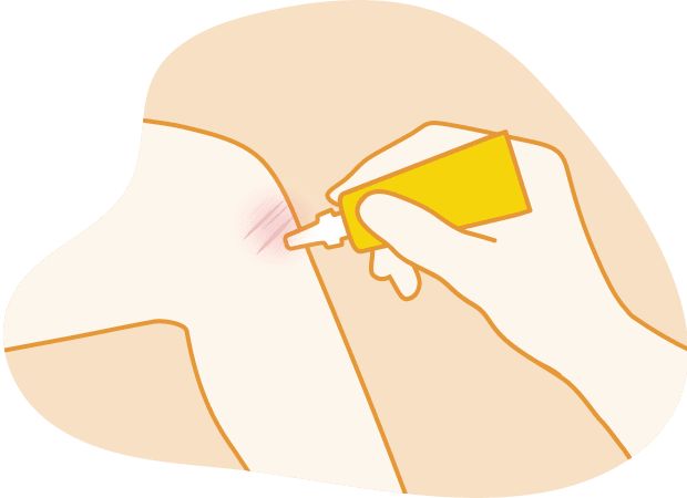 Illustration of a hand applying antibiotic ointment from a yellow tube to a minor cut on an arm to prevent infection.