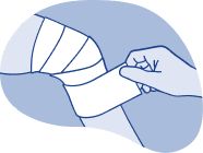 Illustration of a hand applying a bandage to a wound, emphasizing the importance of keeping the wound clean, covered, and dry after surgery.