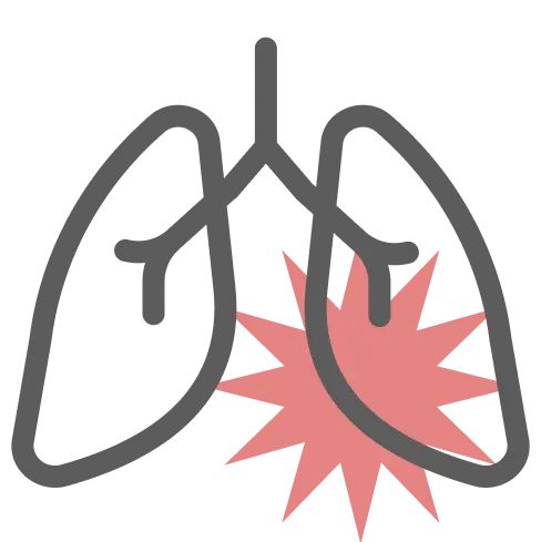 Asthma