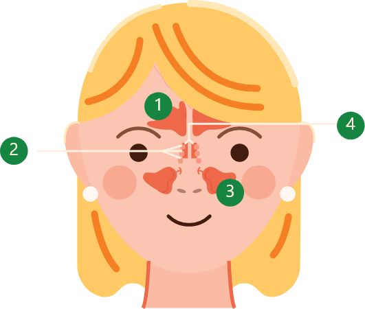 Diagram showing the 4 types of sinuses