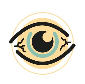 Red eyes