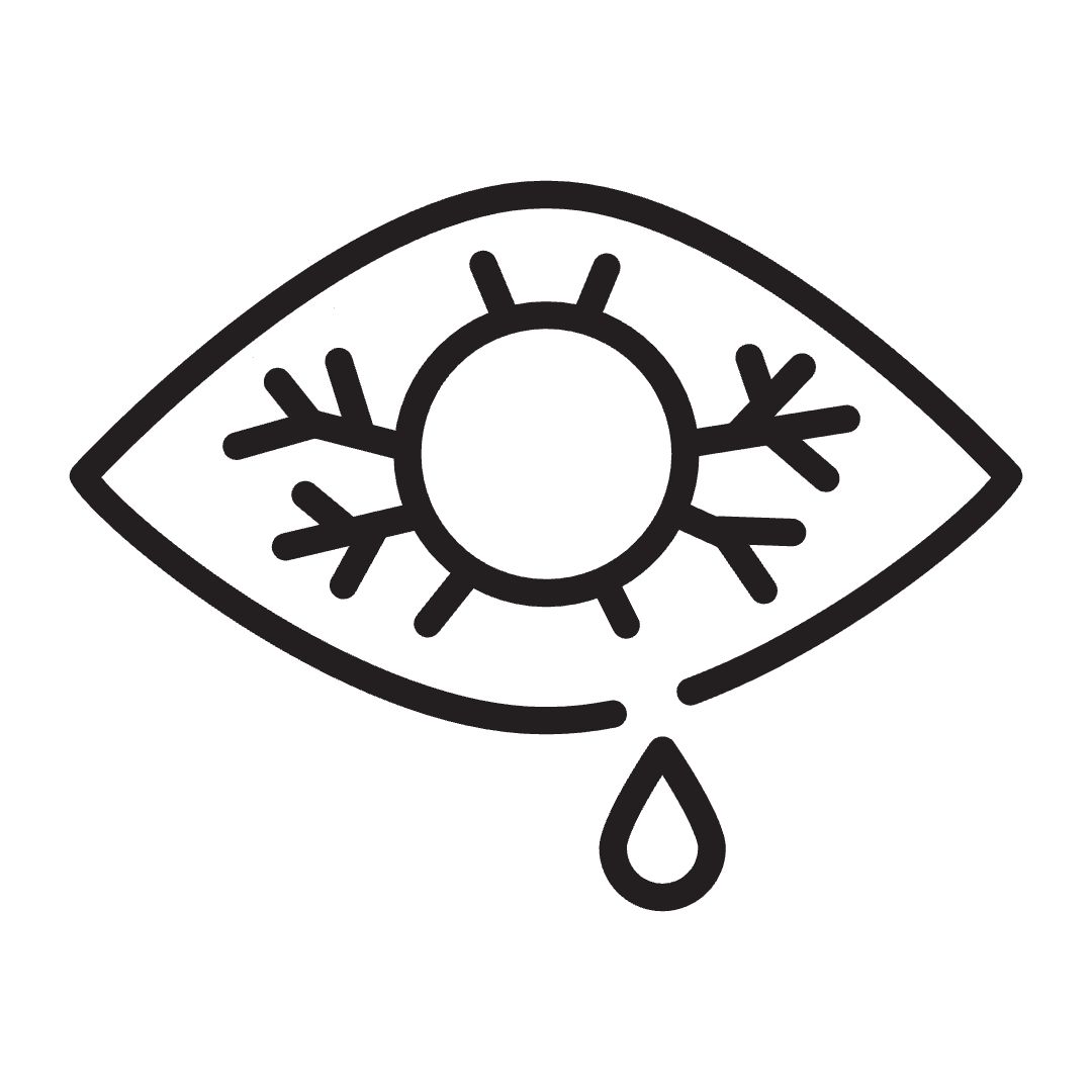 Itchy, watery eyes