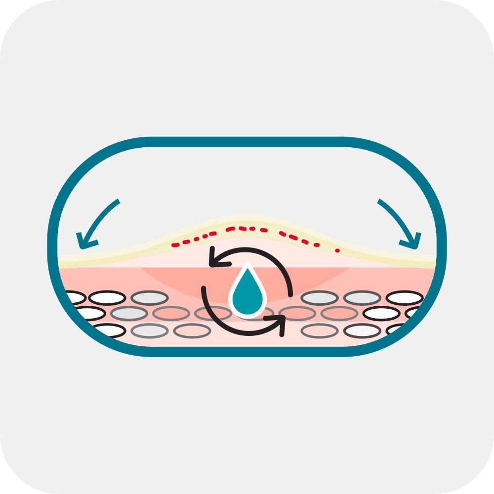 Advanced hydrocolloid technology which creates a moist environment