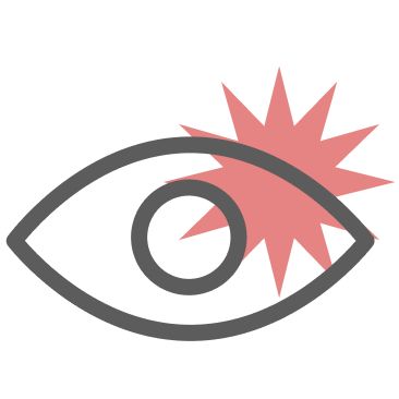 Itchy Eyes
