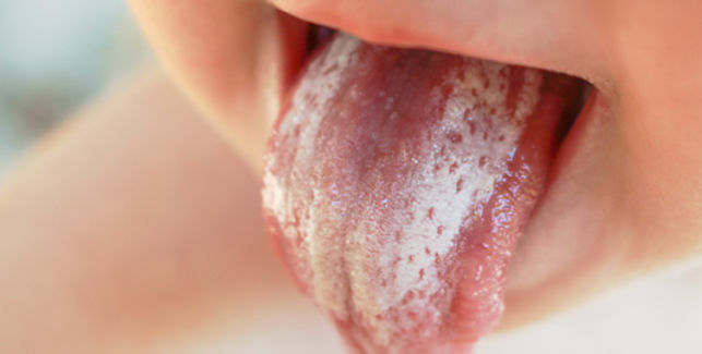 Die Haufigsten Kinderkrankheiten Scharlach Lillydoo Magazin Die Haufigsten Kinderkrankheiten Scharlach Lillydoo Magazin