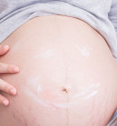 5 Tipps gegen Dehnungsstreifen in der Schwangerschaft