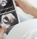 Ultraschalluntersuchungen in der Schwangerschaft