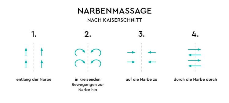 Narbenmassage nach Kaiserschnitt