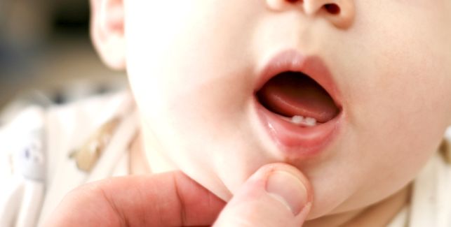 Bébé avec ses deux premières dents