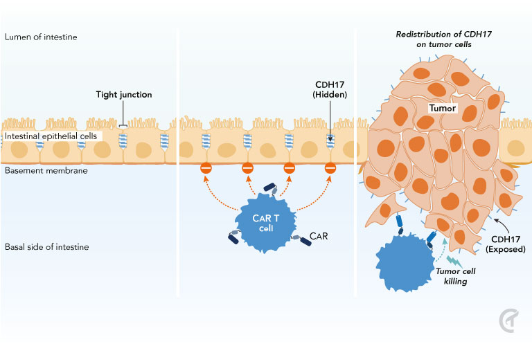 Chlorotoxin CAR T treatment pathway