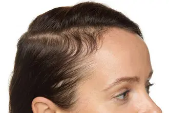 can-i-prevent-postpartum-hair-loss-tips-for-new-moms