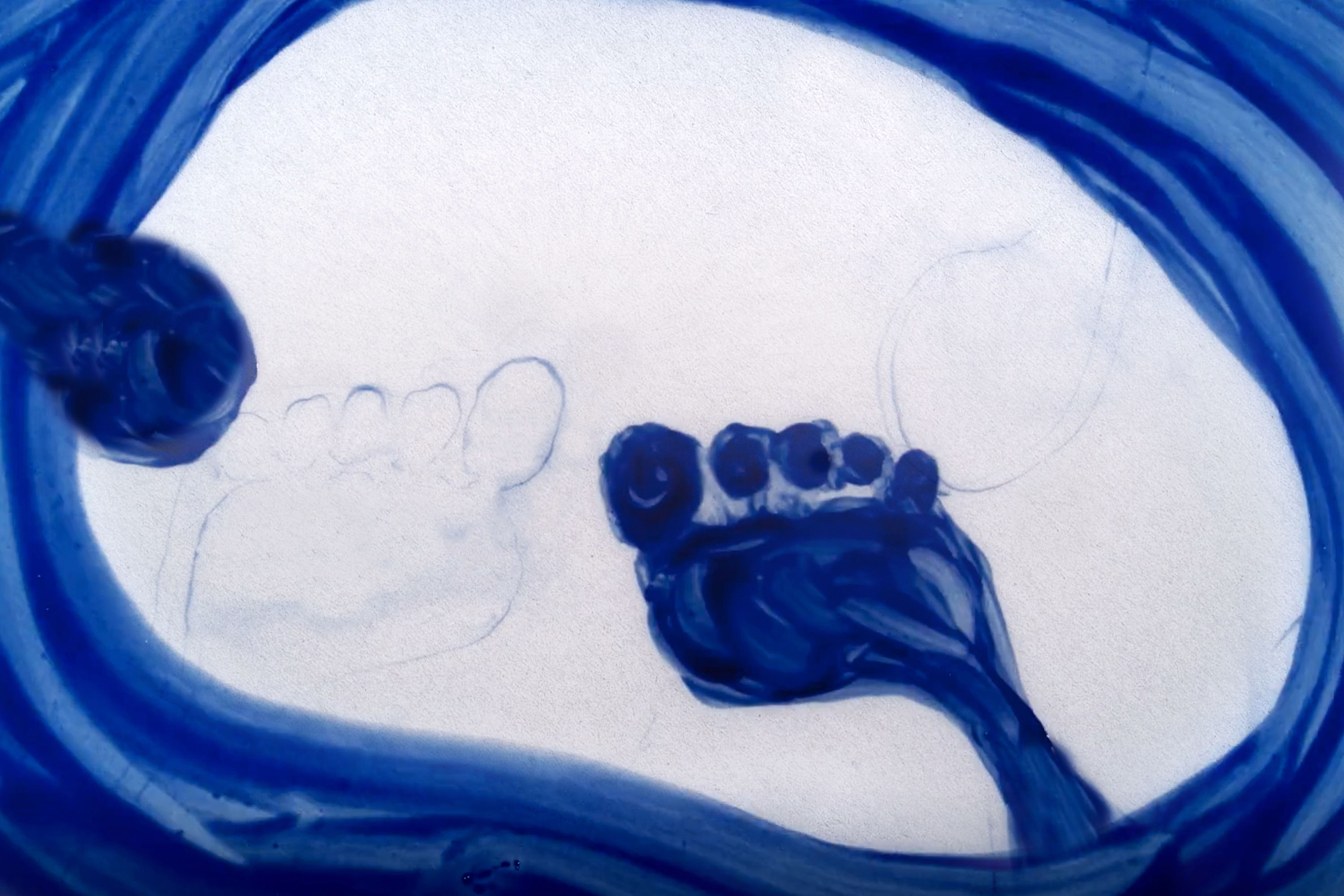 Picturing Cancer: Puddles