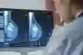 Doctor looking at breast scan